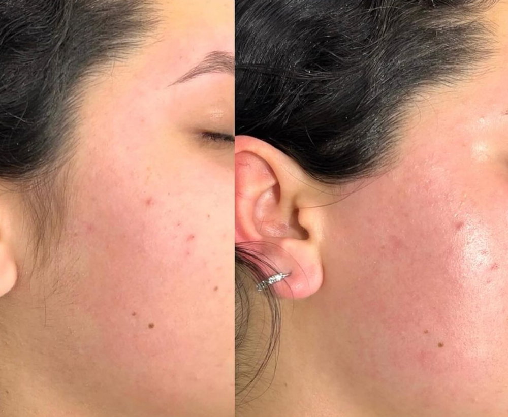 Side burns at BEAUTYNESS LOUNGE in Aurora, CO