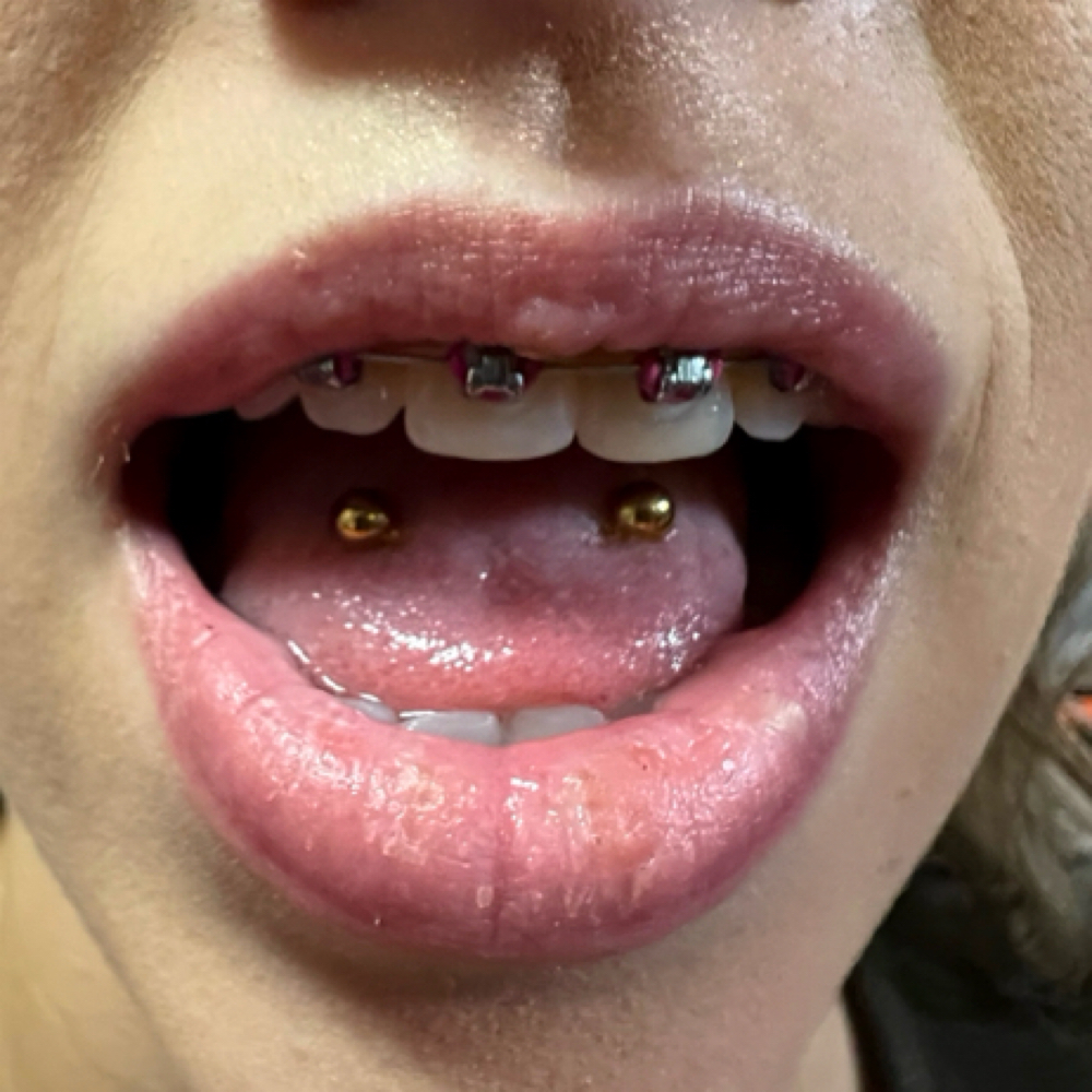 Frog Eyes (tongue) at Calico Creek Tattoo Co. in Wichita, KS