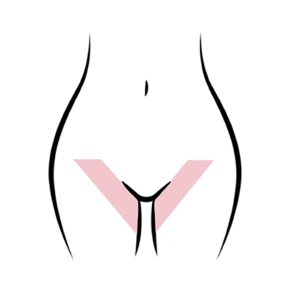 Bikini at Bare & Restored Aesthetics in Burleson, TX