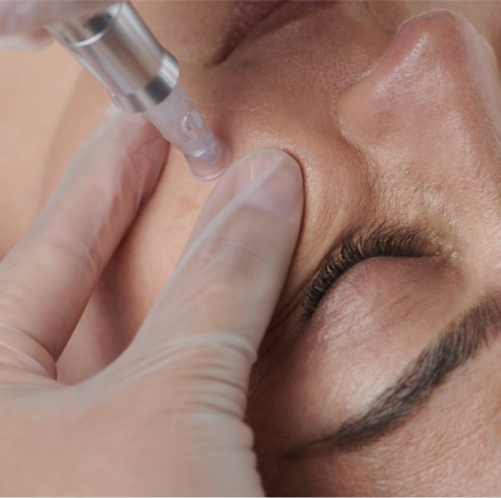 NanoInfusion Facial at Head in the Clouds Spa in Canton, OH