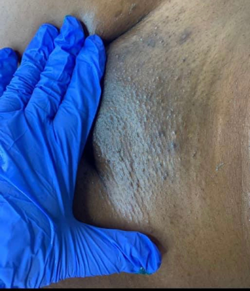 Brazilian Wax