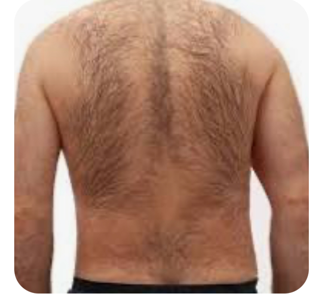 Men’s Back Or Chest Wax