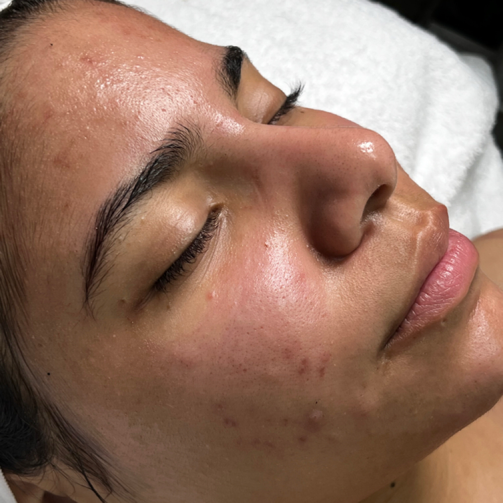 Deep Pore Cleansing Facial at CD The Beauty Bar in St. cloud, FL