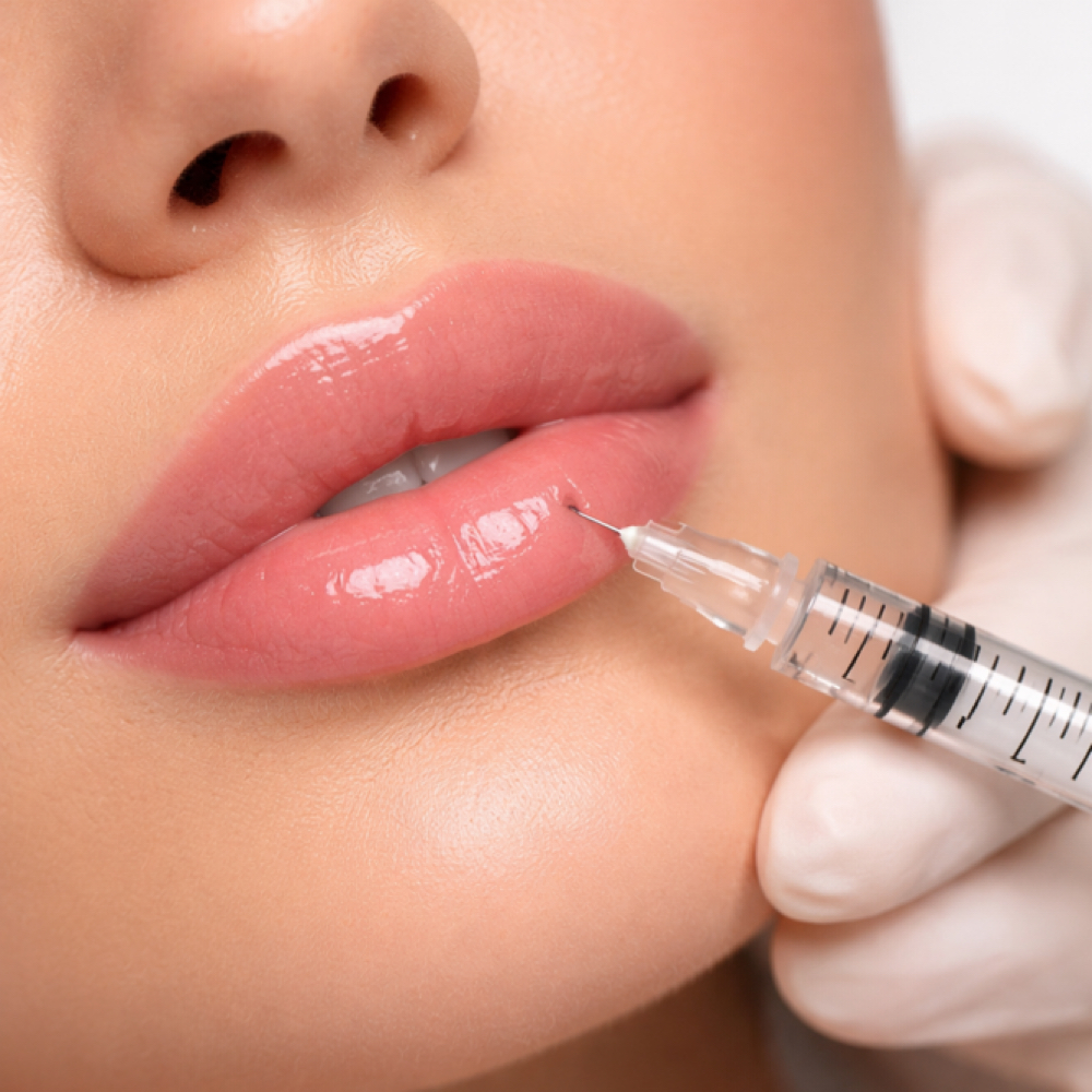 Full Syringe Of Filler at Glow & Go Aesthetics in St Albans, WV