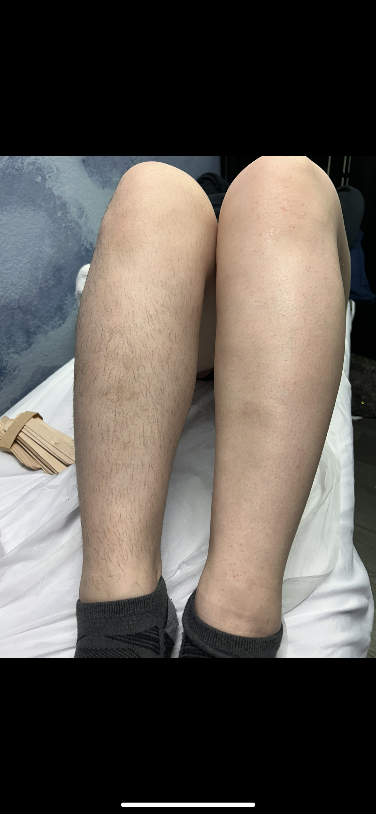 Full Legs/Arms Wax