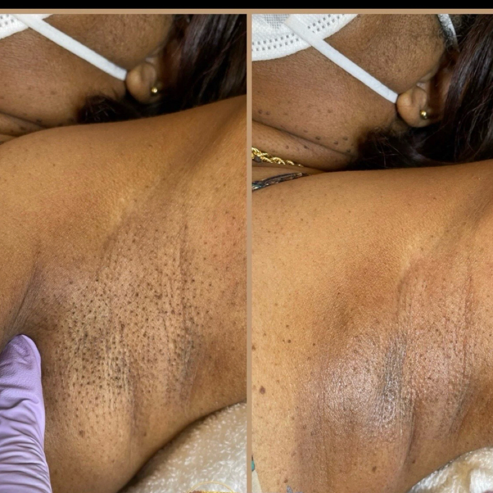 Underarm Wax at KIYAMONETSKINCO in Westchester, IL
