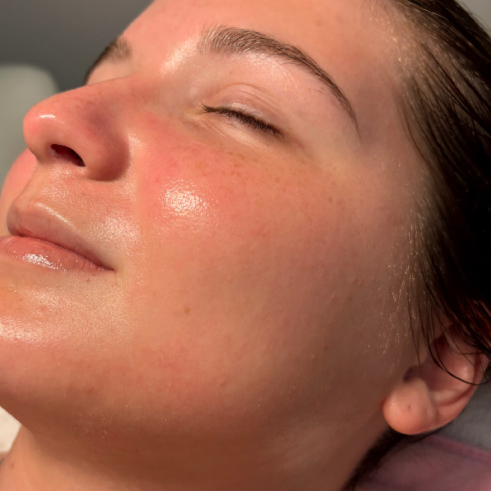 Event Prep Facial at Naturally Esthetics in Myrtle Beach, SC
