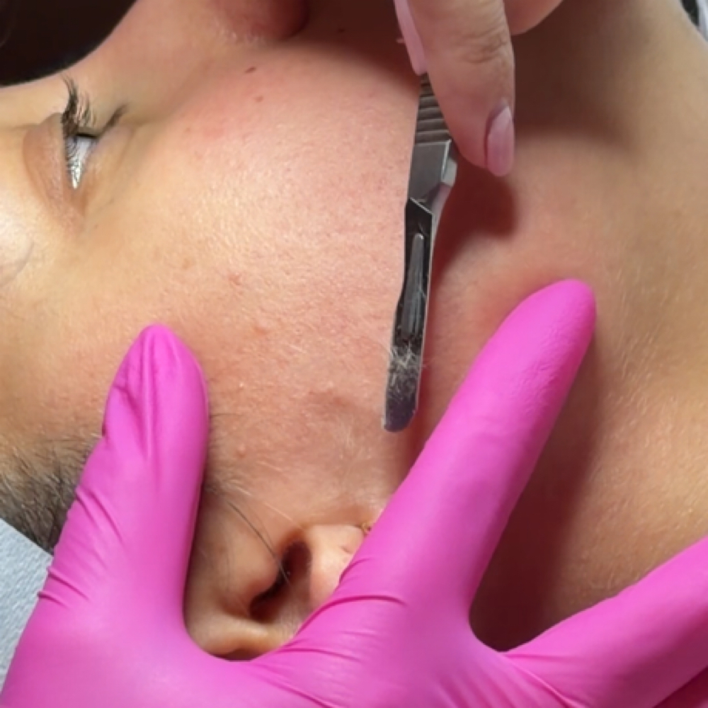 Dermaplane Facial at Angela’s Beauty Lounge in Wakefield, MA