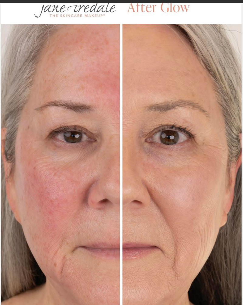 Derma Glow