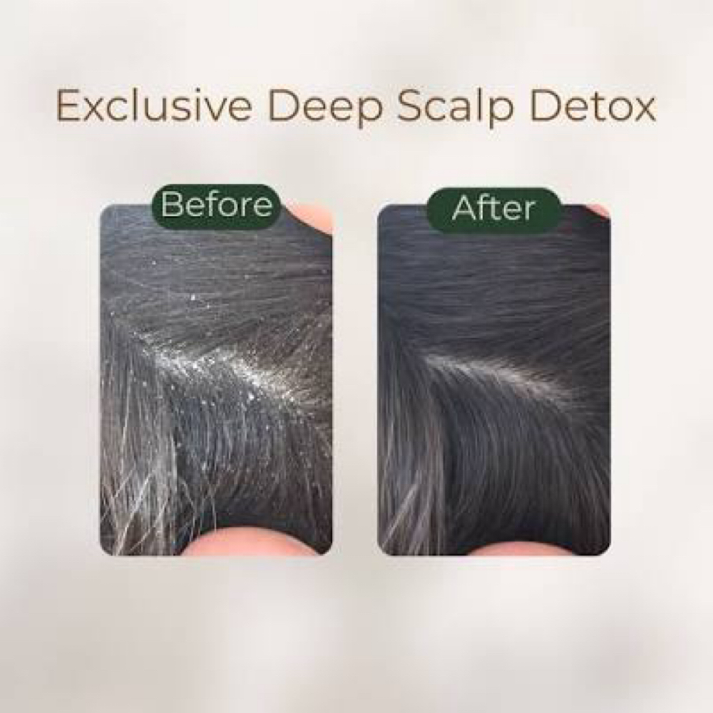 Scalp Detox Treatment at Tobs braiding salon llc in Houston, TX