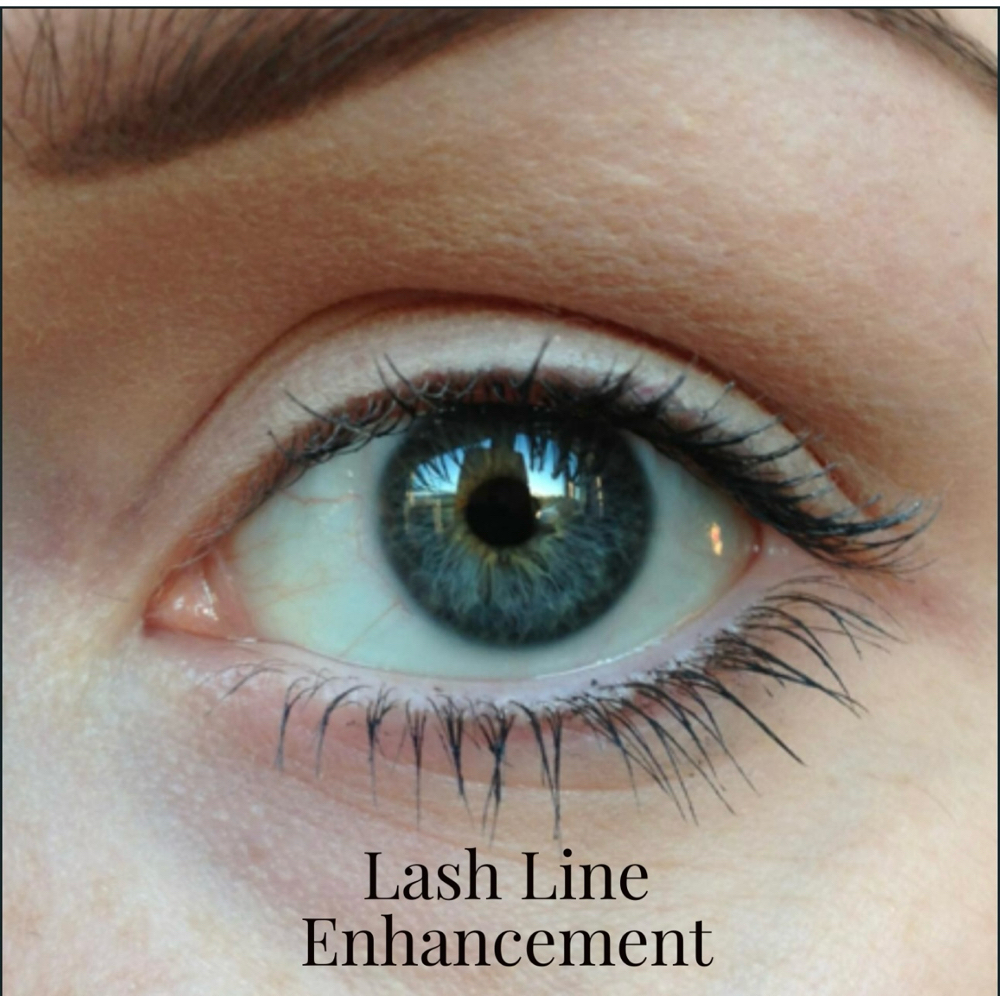 Lash line enhancement