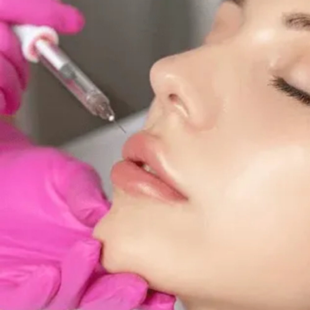 The “Lip Flip” Botox at Finesse Sculpt Body Studio in Parkville, MD