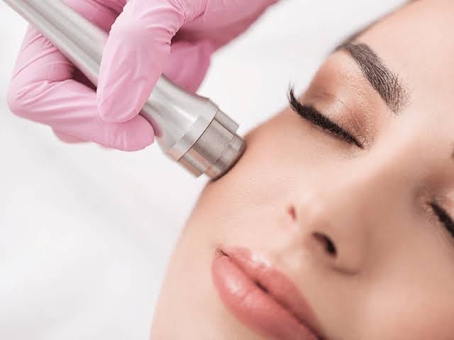 Microdermabrasion (Face/Back) at Beauty Cult Studio