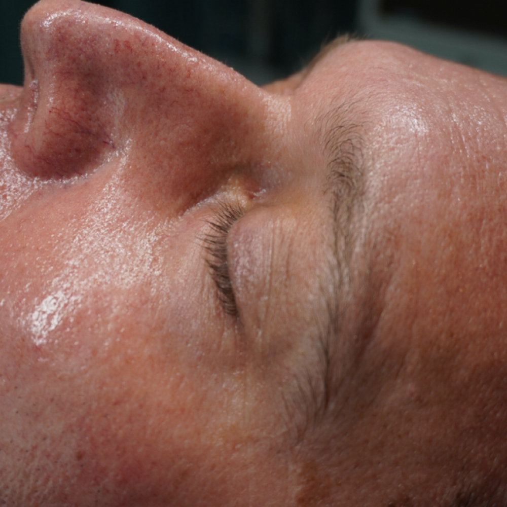 L-IFT System at Botanic Skin Spa in Lewisville, TX