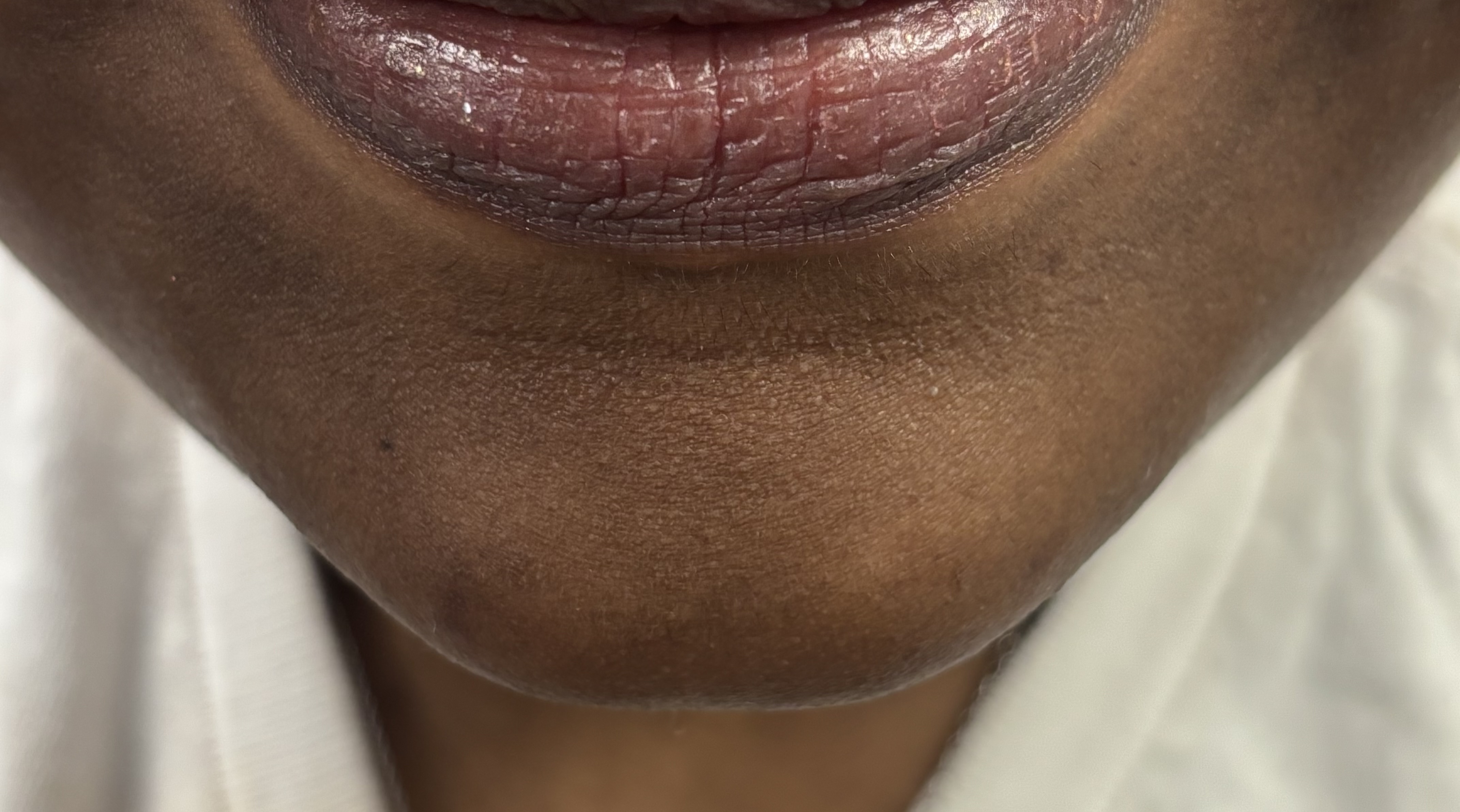 Chin wax