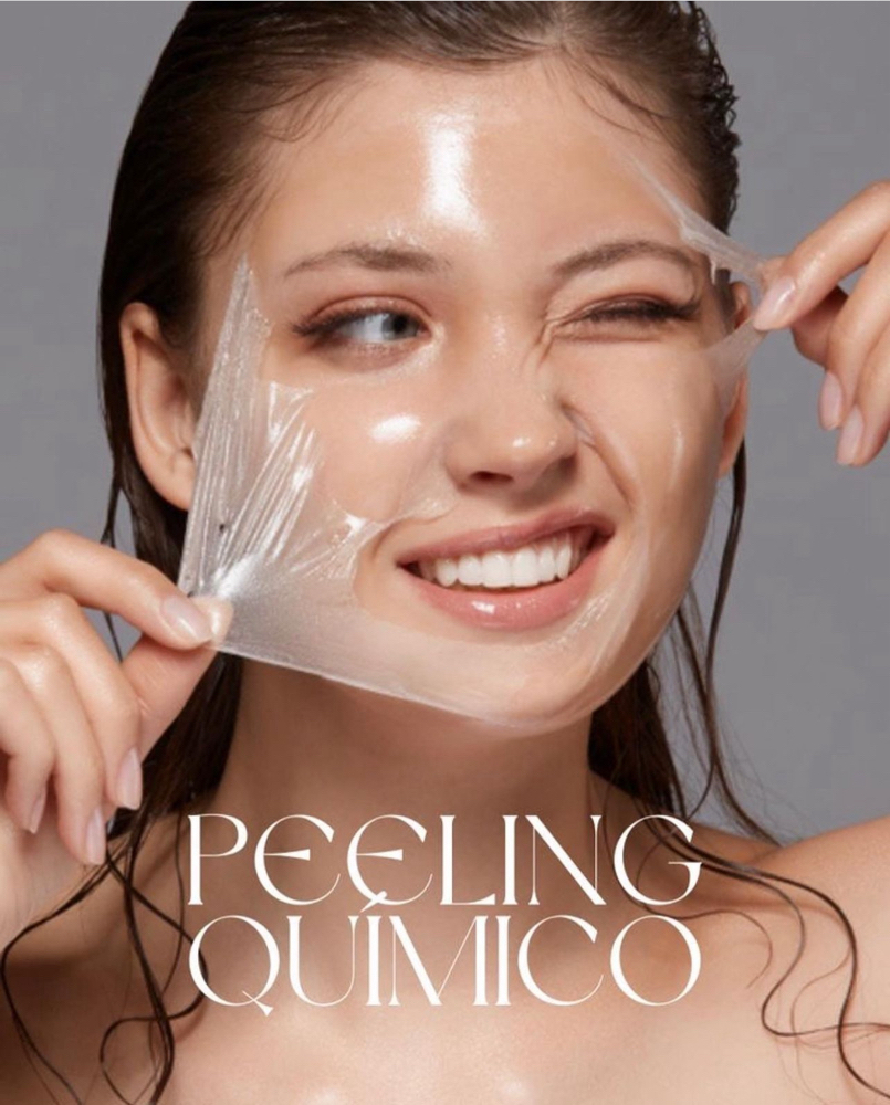 PEELING QUIMICO