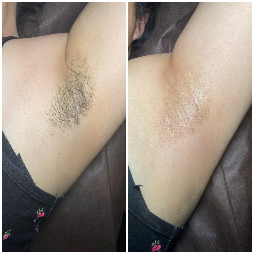 Silk Underarms ✨ at SugarandSlayy in Dallas, TX