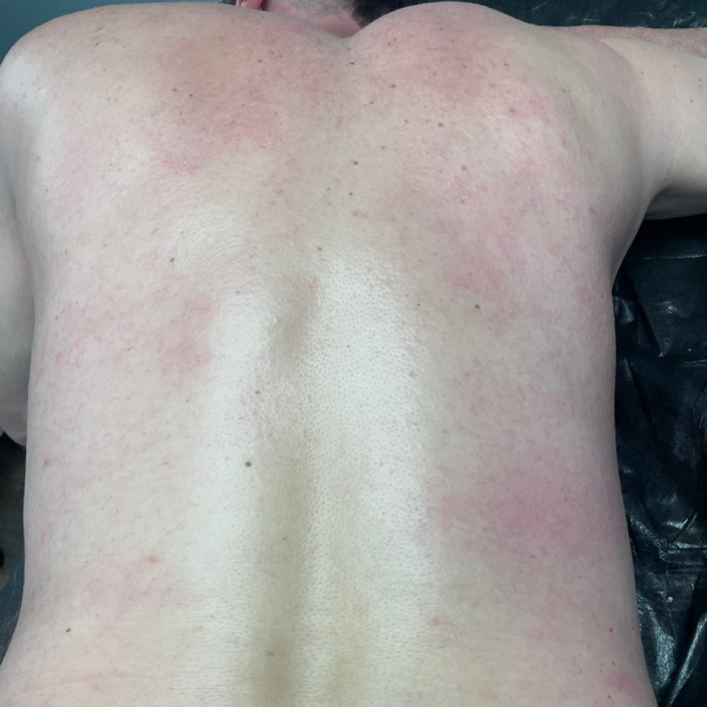 Full Back Wax at The Sweet Spot Est. & More in Alexandria, LA