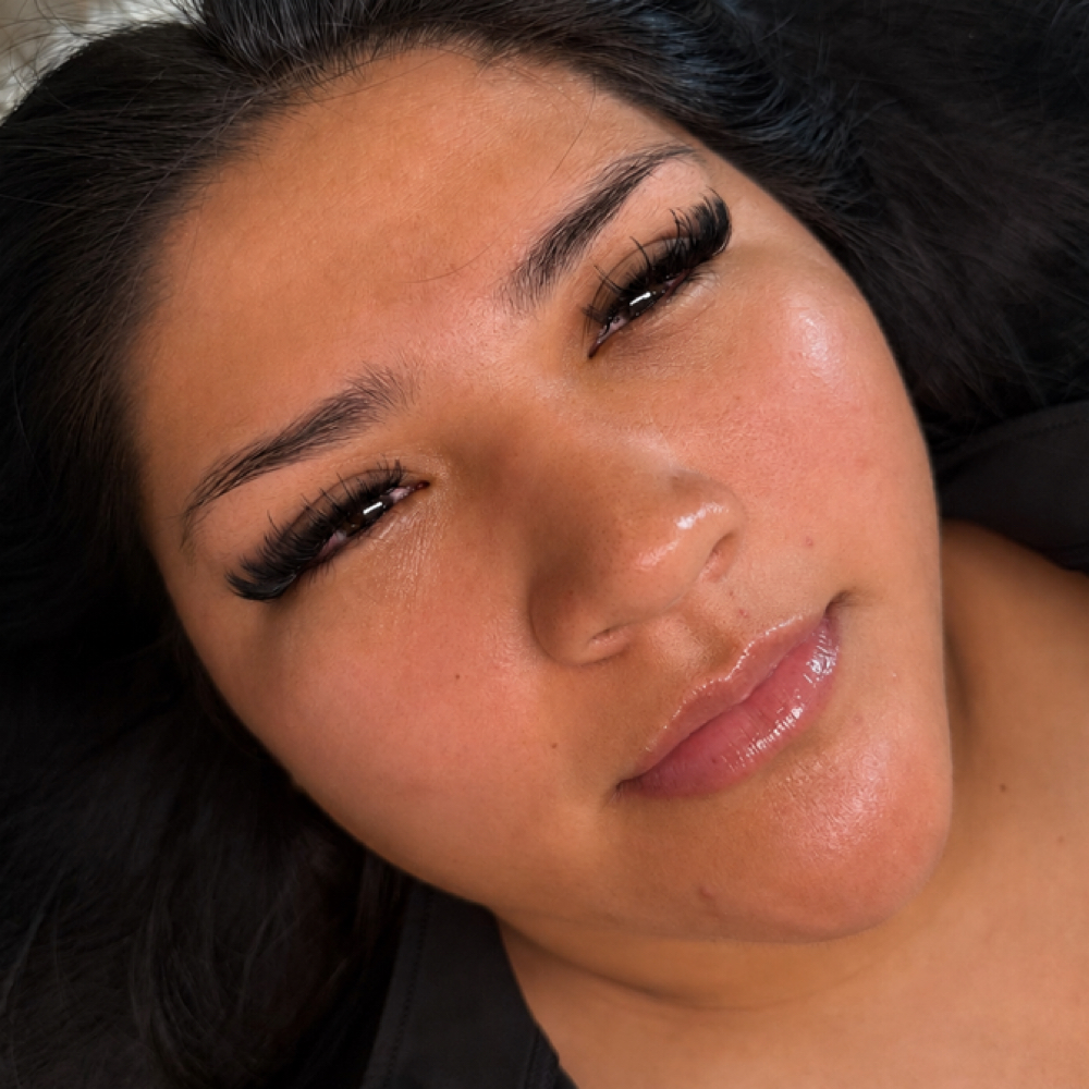 Volume Fills at Aurora Aesthetics 888 in Olean, NY