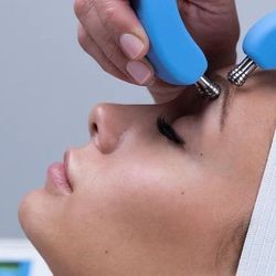Add Forehead & Eye Lift  MC