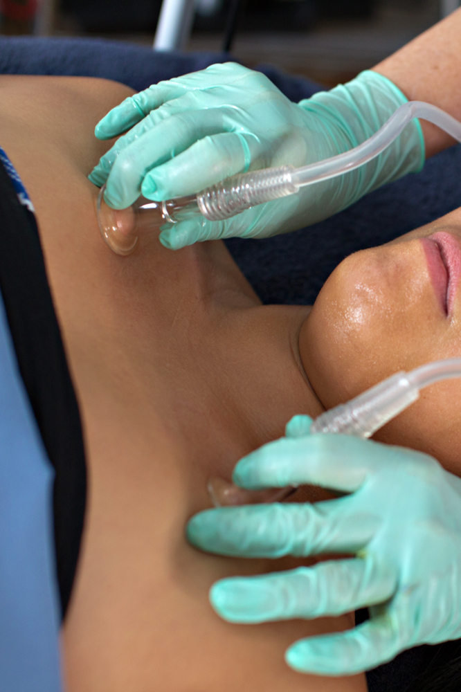 Cupping For Bloat And Sinus Relief