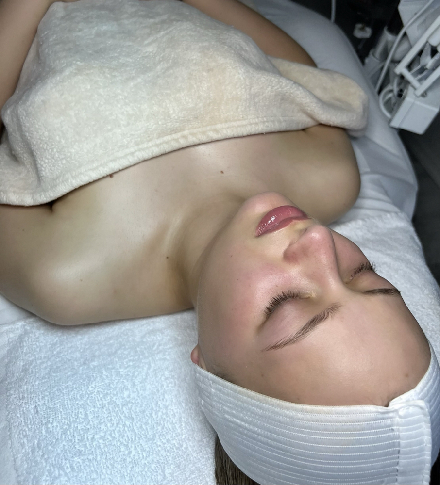 Acne Bootcamp