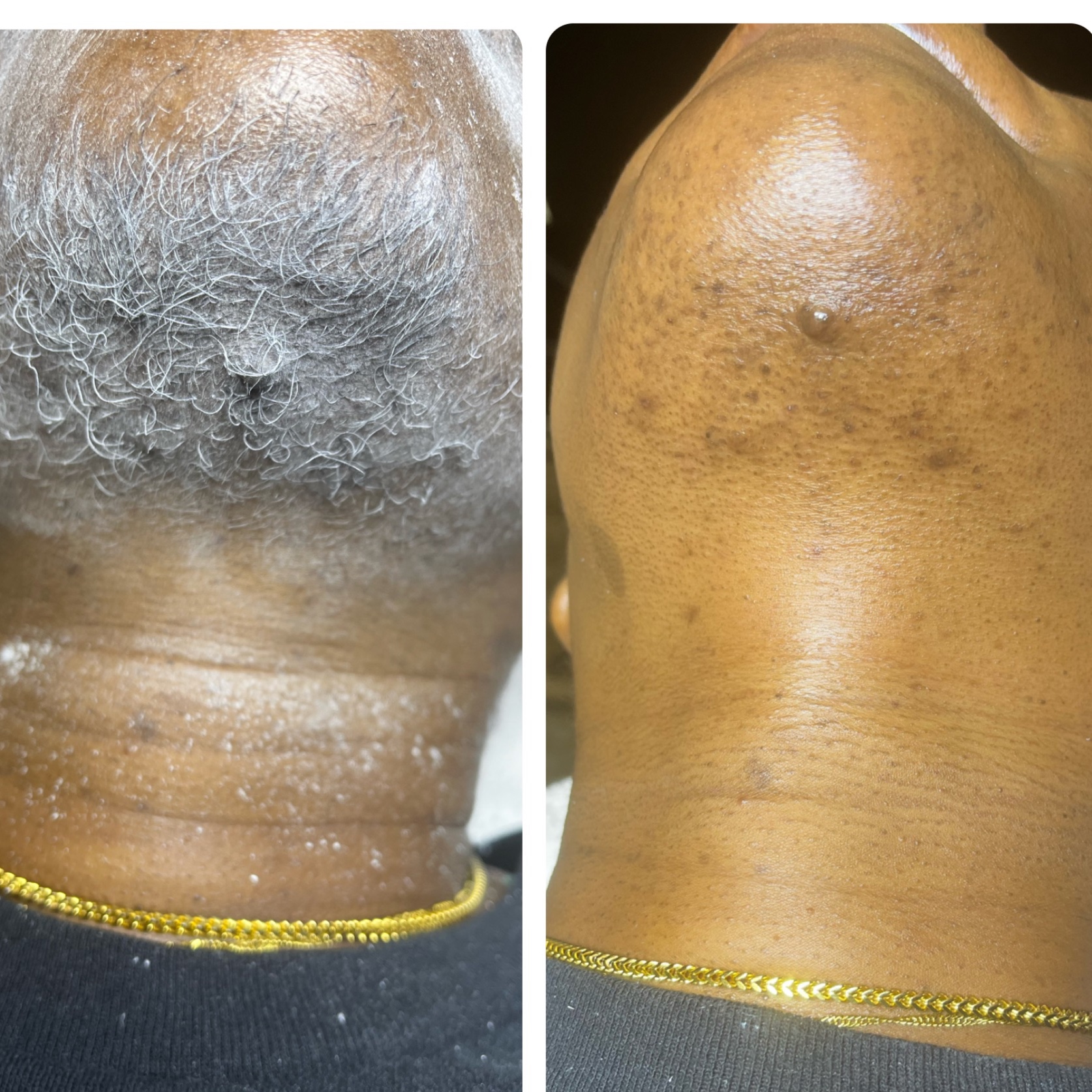 Chin Wax at The Complexion Parlor in Georgetown, SC