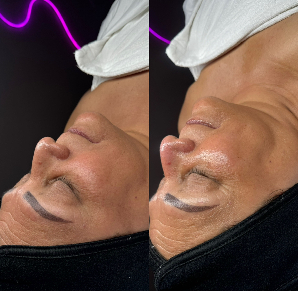 Anti-Aging Facial