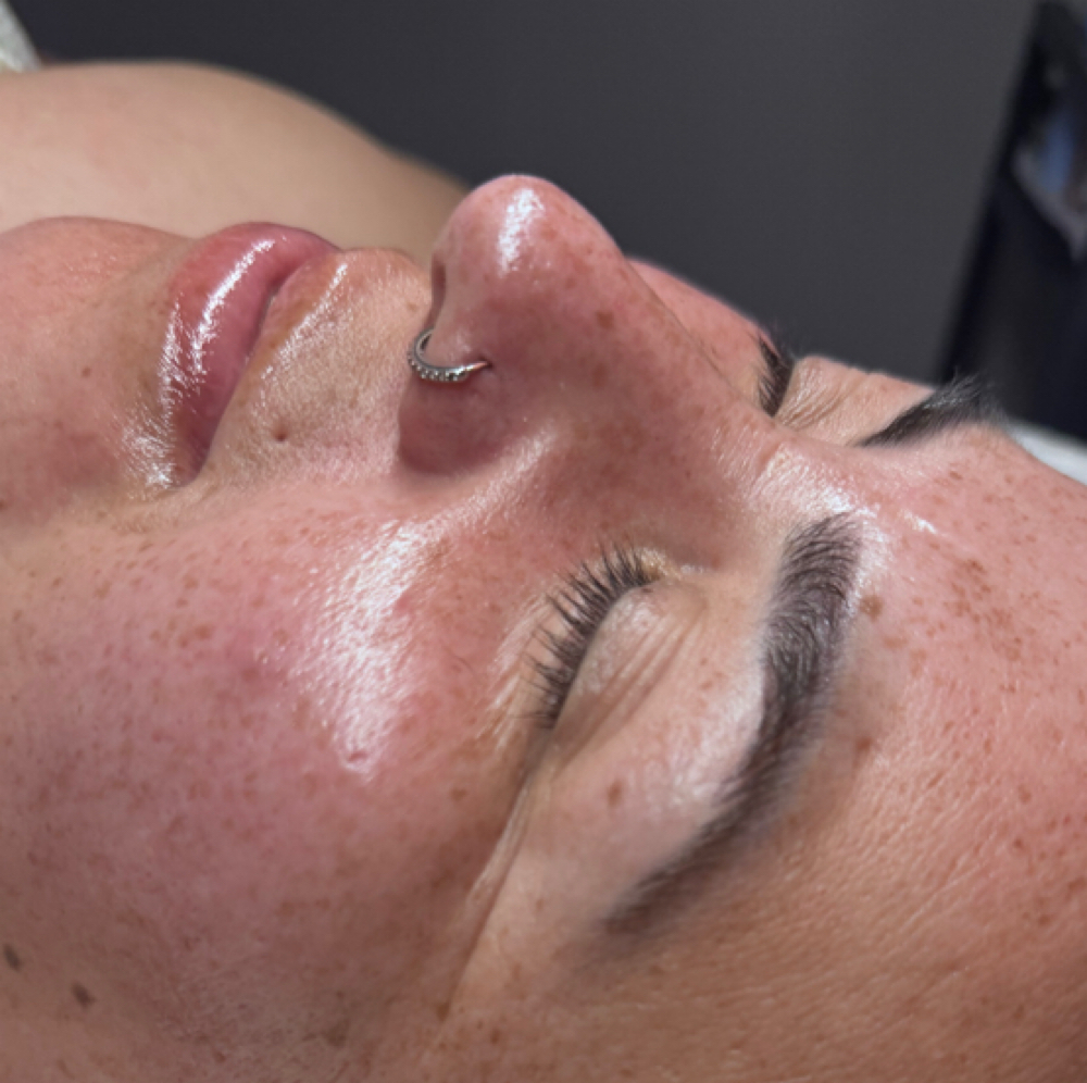 The Dermaplane Treatment at Jessica Serna Skincare in Modesto, CA