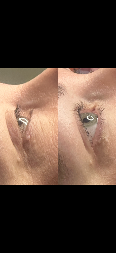 Lash Lift