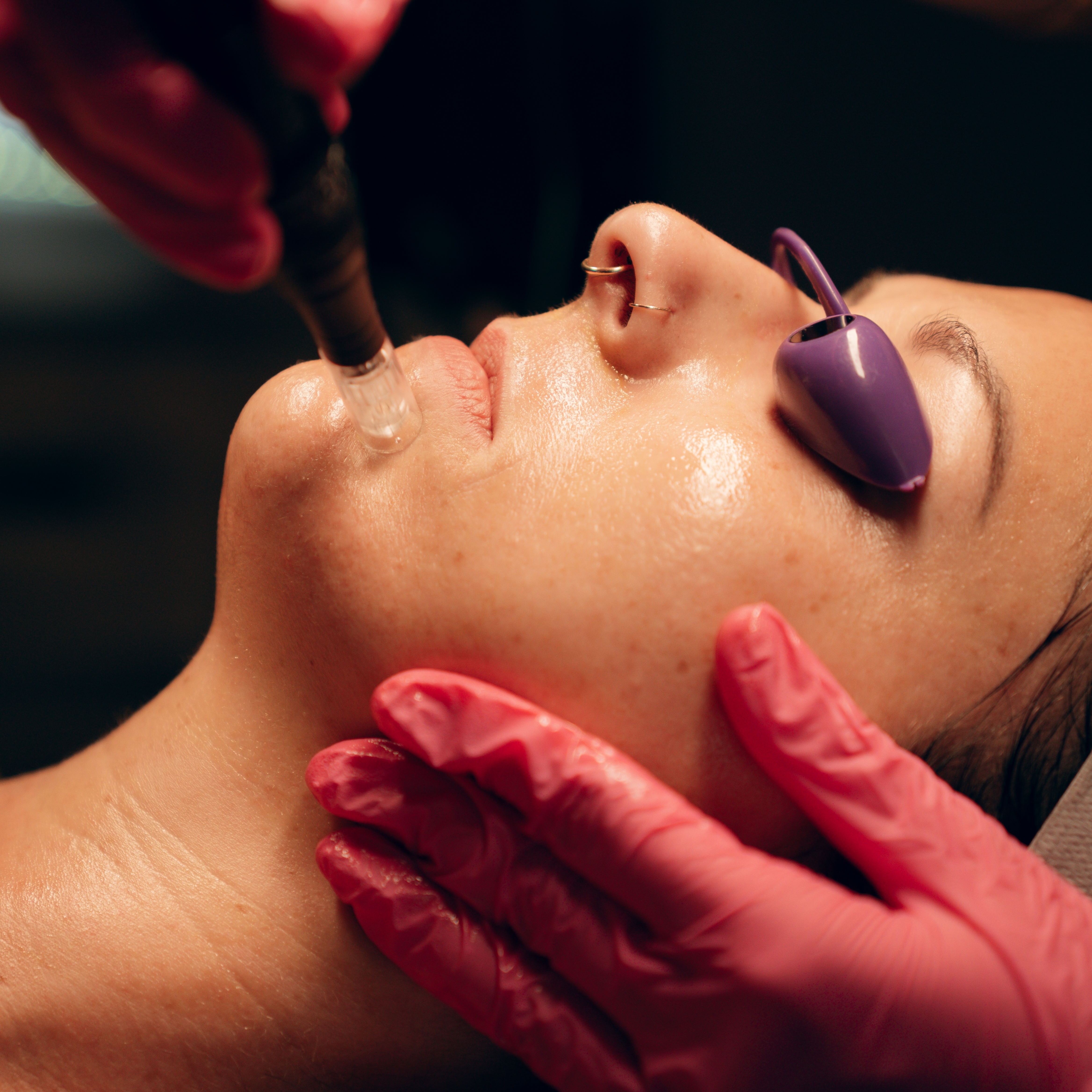 Microneedling at Skin Positive by Liz in Elizabethtown, PA
