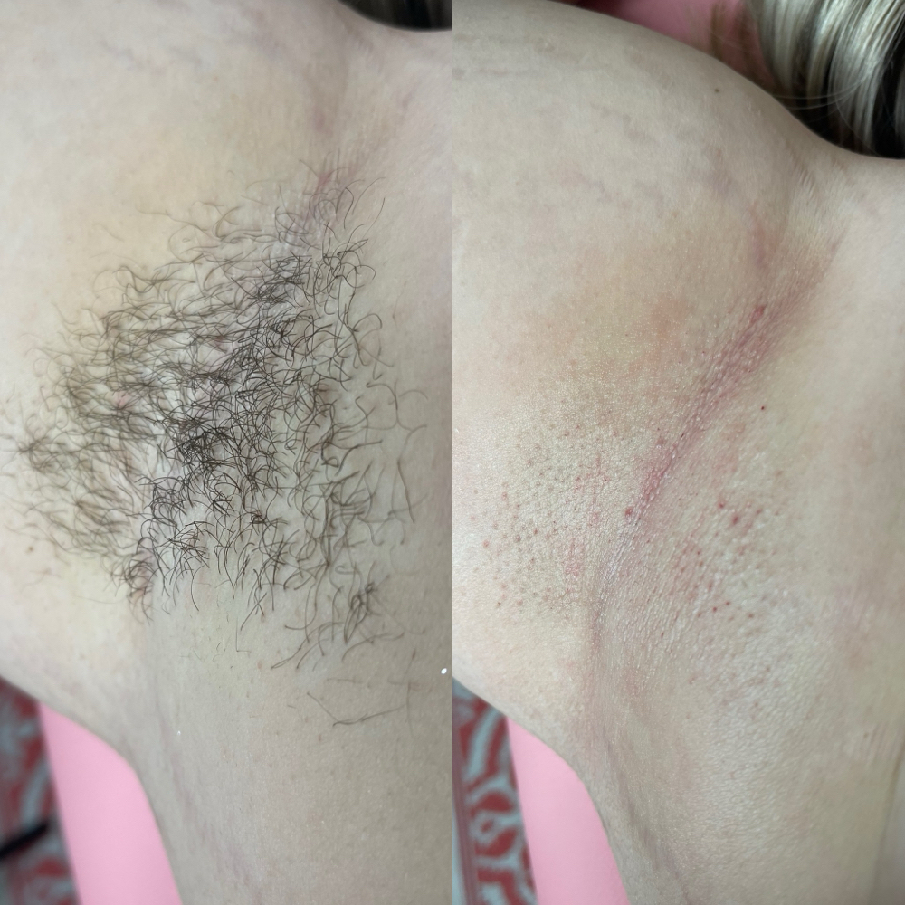 Underarm Wax