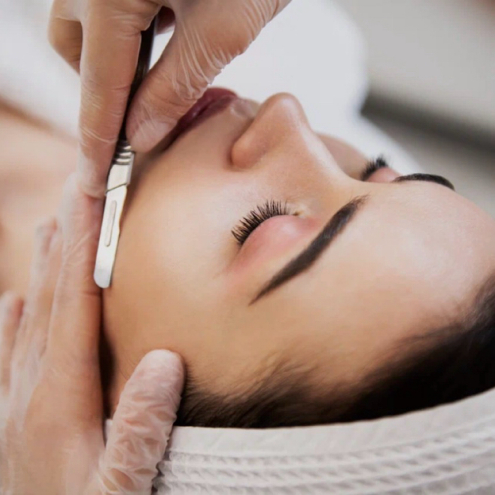 Dermaplanning Add-On at “Illuminate” Skin By Mariah in St. Louis Park, MN