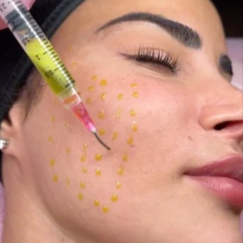 BioR+NexG PDRN Diamond Skin Peel at BRILLIANTSKYN in Shelbyville, KY