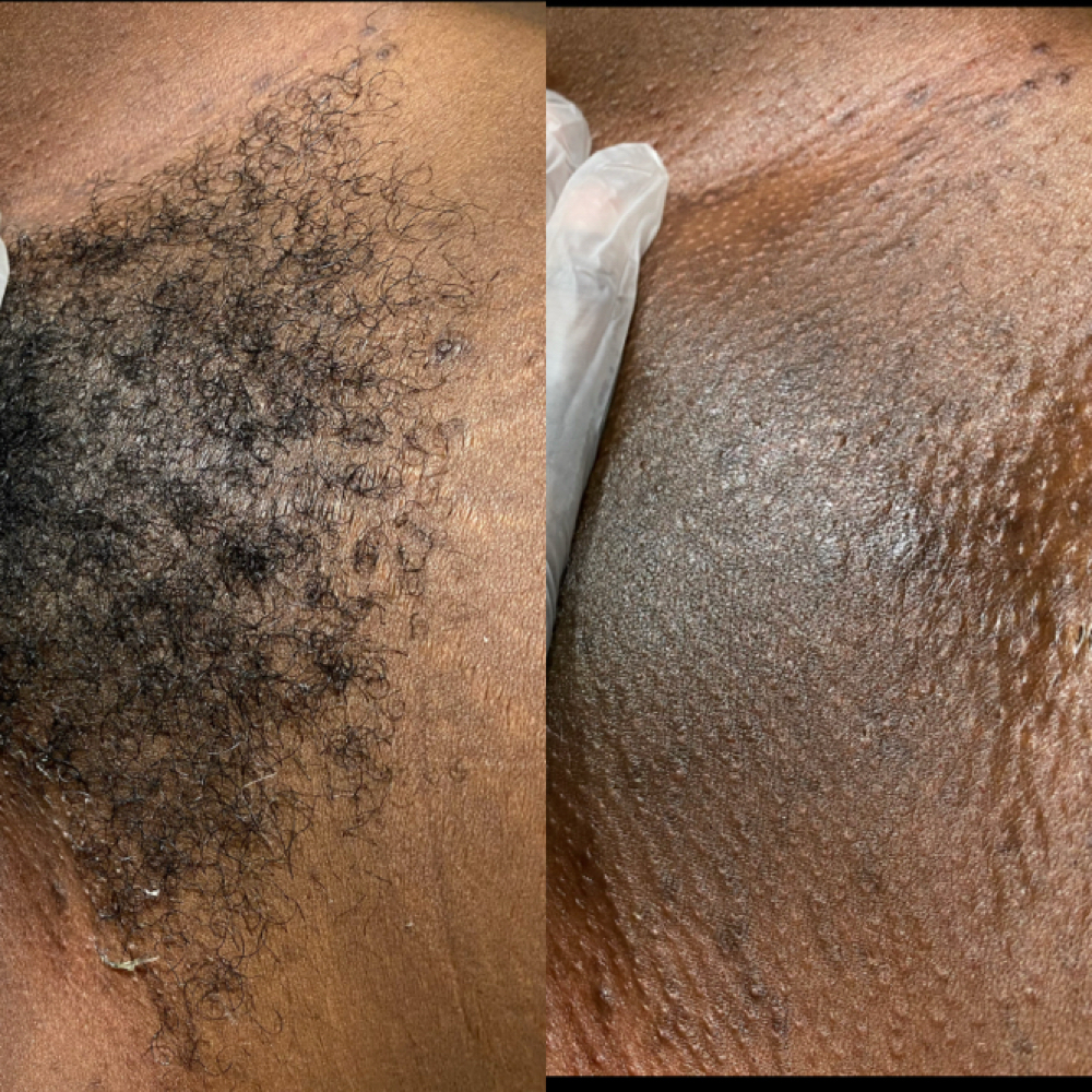Brazilian Wax( 7+ weeks) at Waxxaholics Beauty & Body in Grand Prairie, TX
