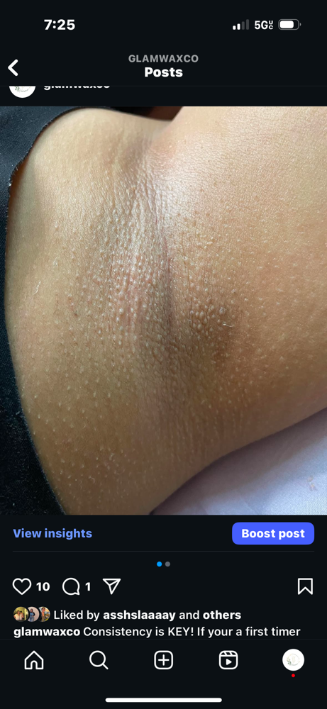 Underarms