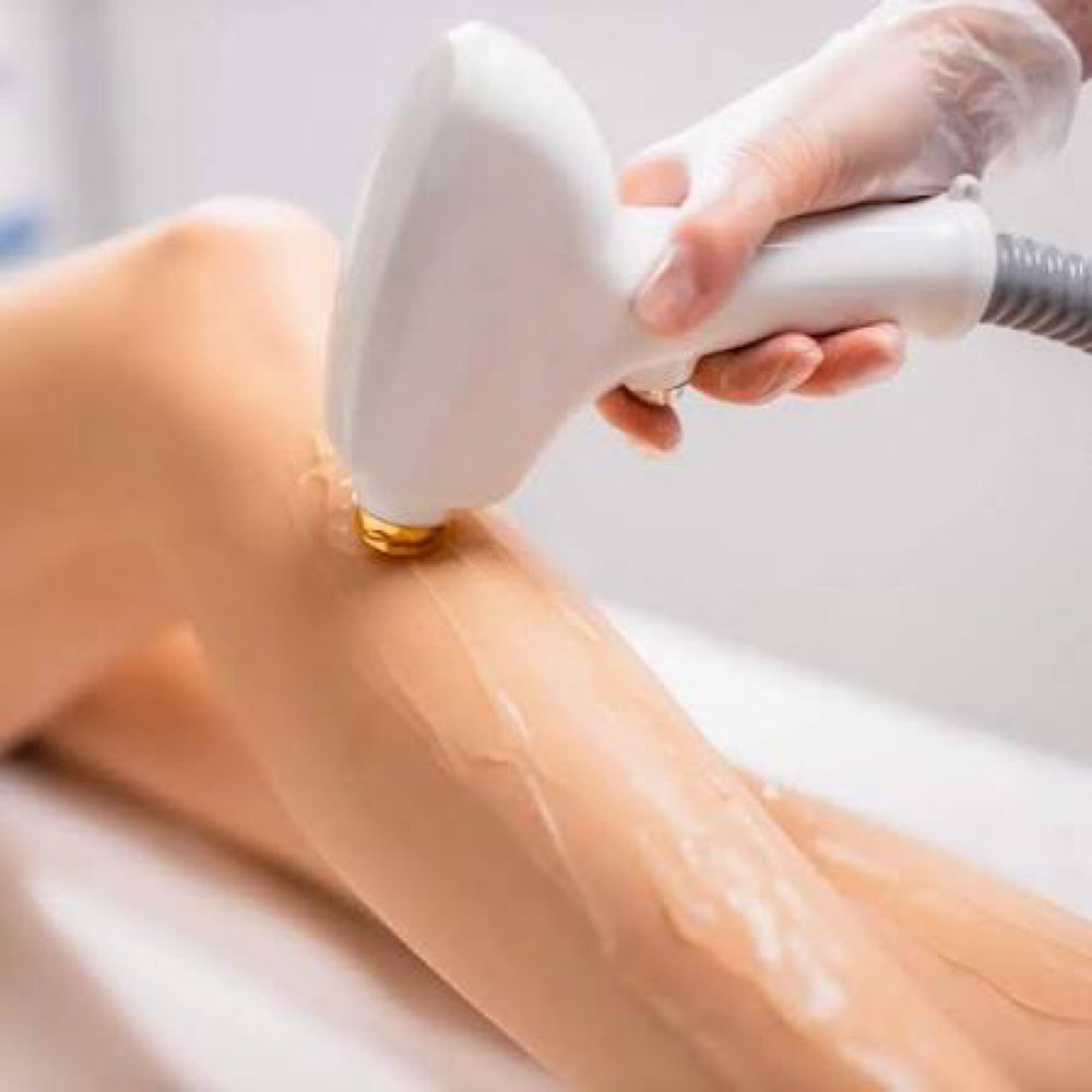 Laser Hair Removal Half Legs at All Aesthetics Kare in Upland, CA