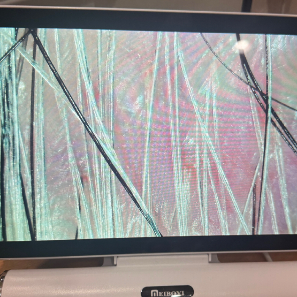 Scalp Analysis Follow-Up at Root & Crown Luxury Scalp Therapy in Eagle, ID