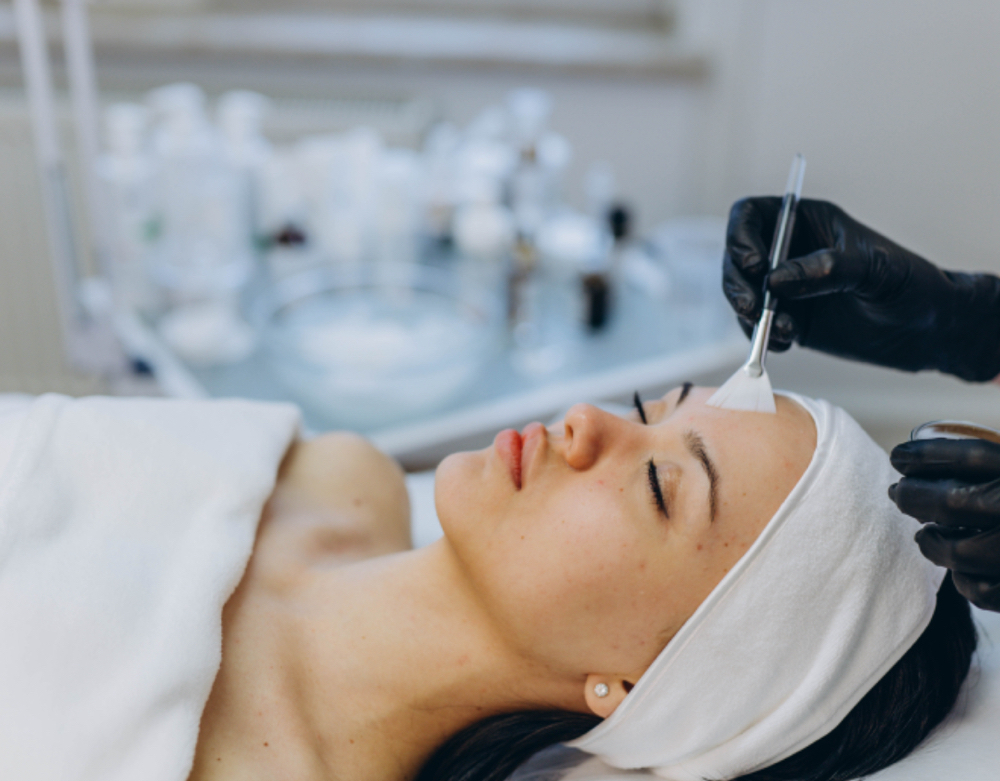 Chemical Peel