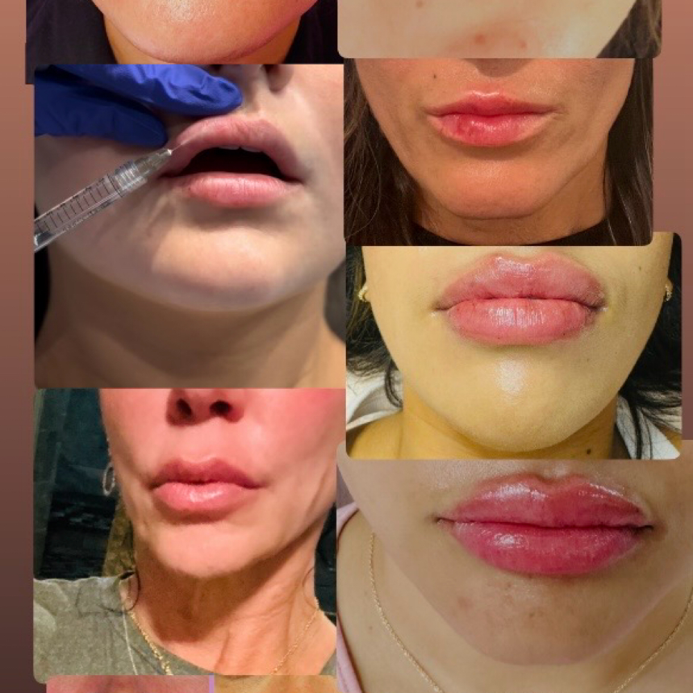 Thursday night WEEKEND DROP at Body Beauty Team in Mckinney, TX