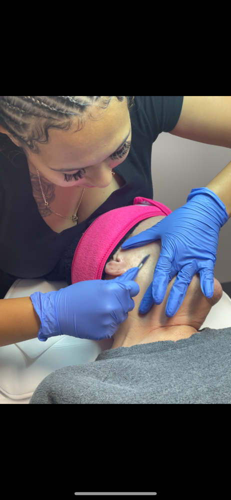 Dermaplane Facial