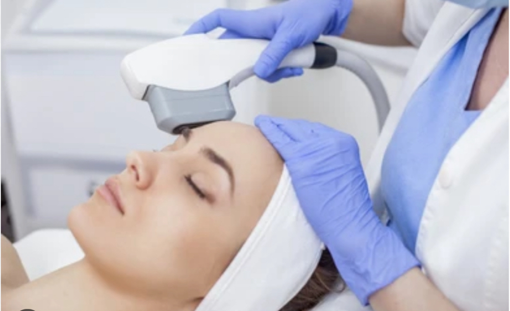 IPL Photo Facial