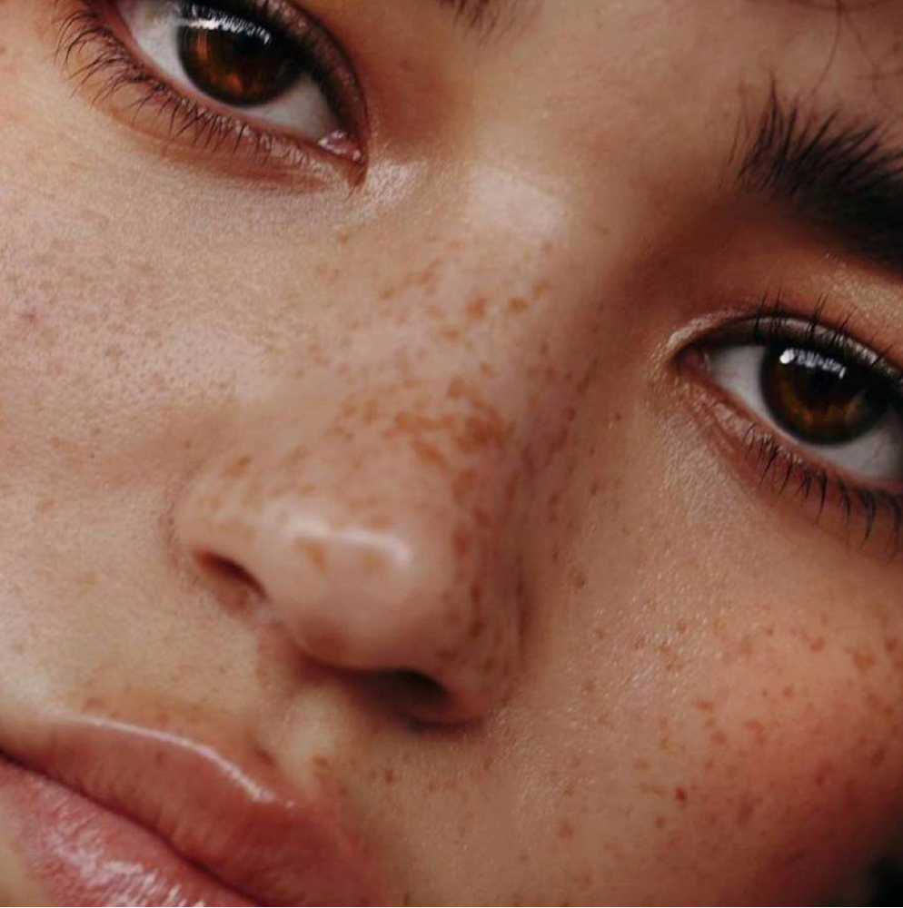 Freckle Tattoo (Beauty Mark Tattoo) at Linny @ Blade Babes Aesthetics in Hernando, MS