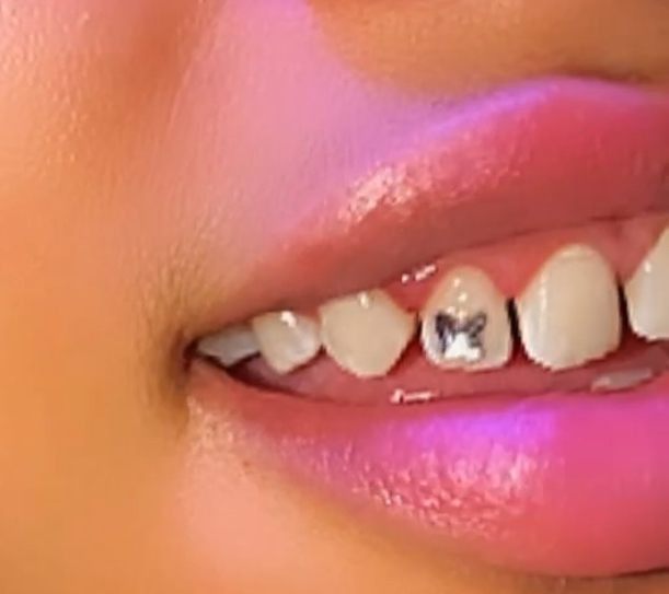 Butterfly Tooth Gem 🦋