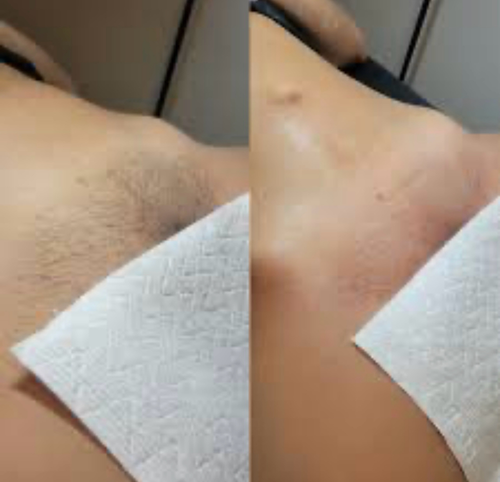 Bikini Wax