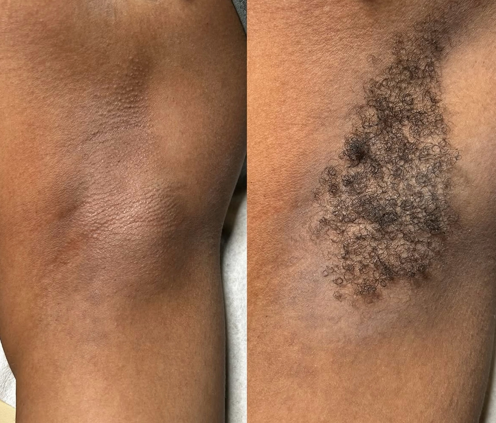 Under Arm
