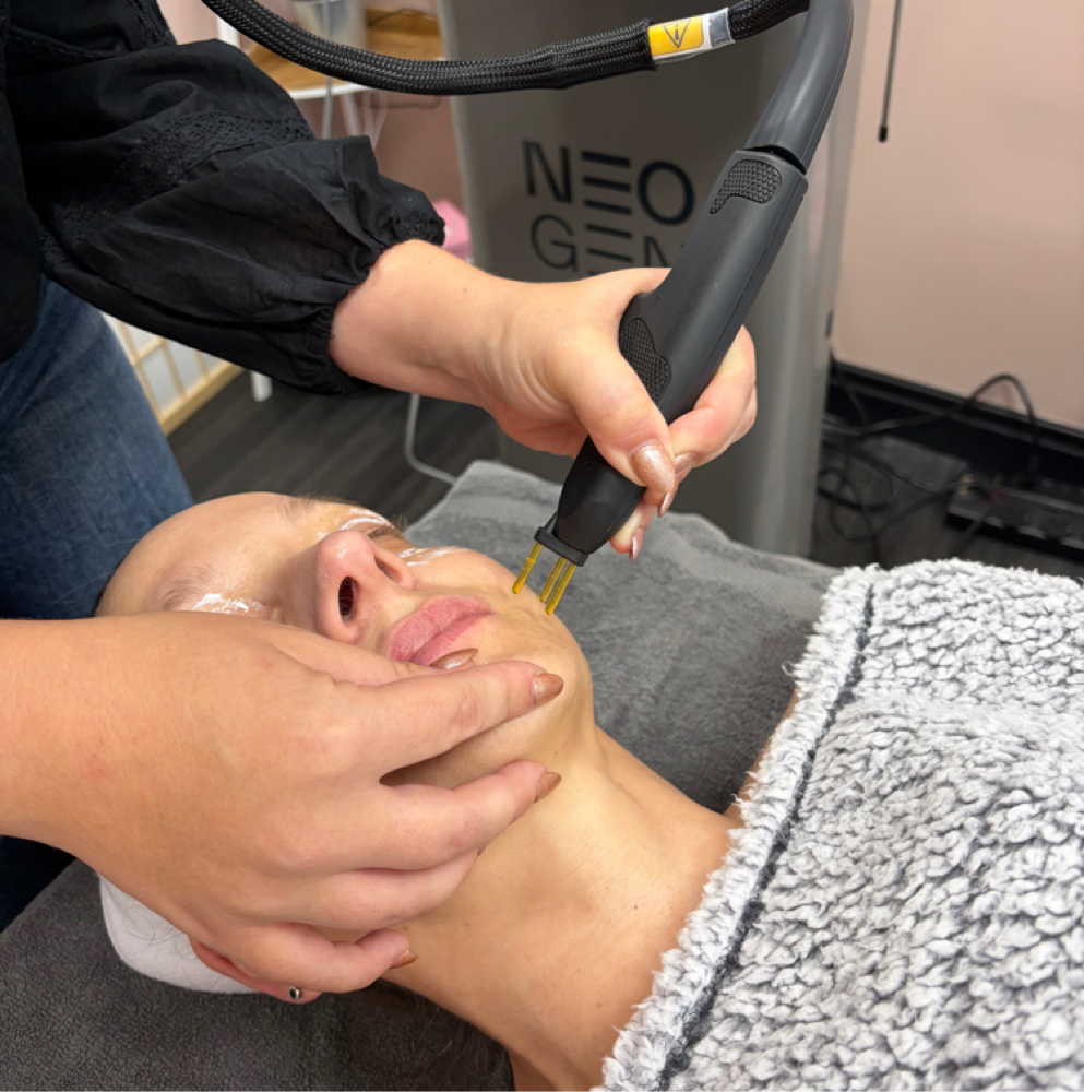 NeoGen Skin Renewal Consultation at Rustic Roots Aesthetics in Trinity, FL