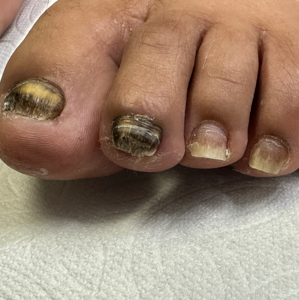 QUIROPEDIA (No Gel) at Confident Foot Care by Aracely Xicara in Huntington Park, CA