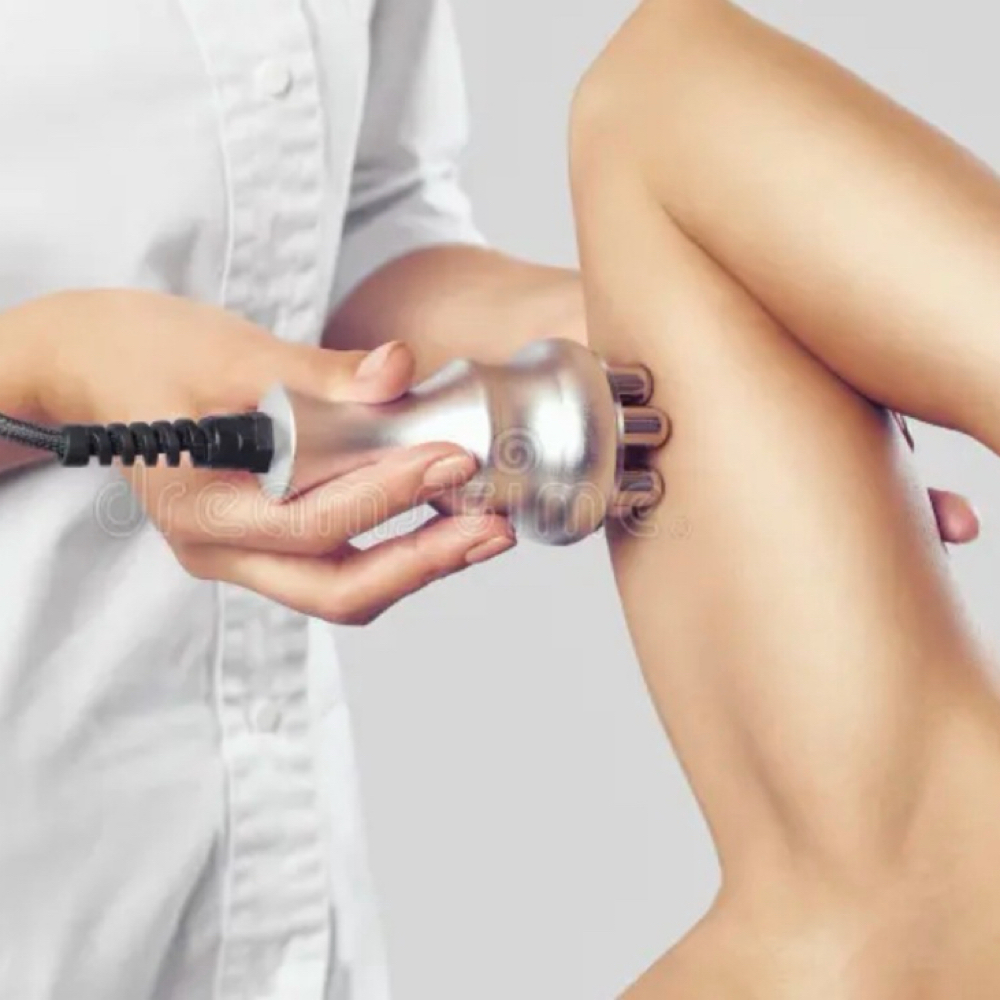 Arm Reduction at Shaneka Hickman in Grantsboro, NC