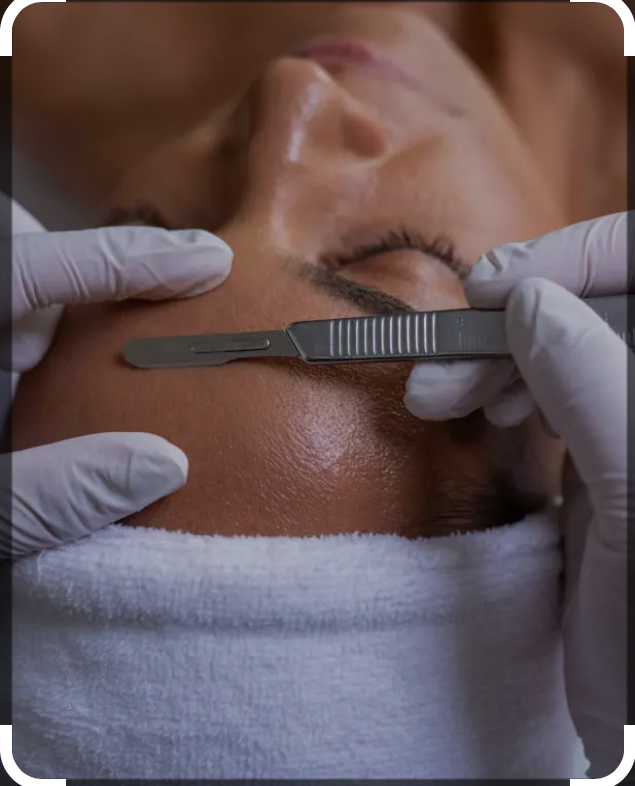 Exfoliation & Hair Removal Add On at Skin by Design in Amarillo, TX